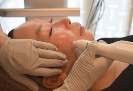 広島市中区のシミケア専門エステサロン﻿「prige」